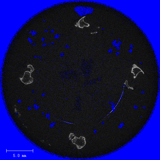 File:Ring artifact.jpg