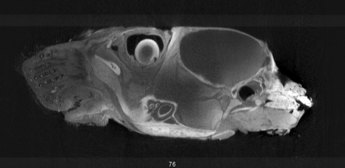 Mouse Head (60µm, YZ plane)