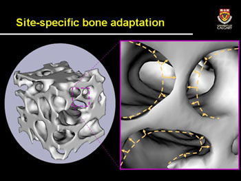 File:Smaller bone loss.jpg