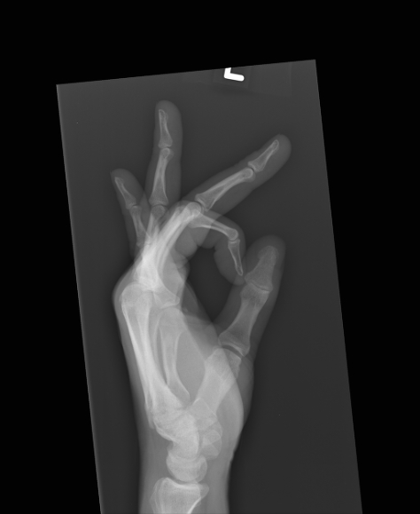 File:Lateral 1.jpg