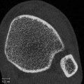 Thumbnail for version as of 21:53, 19 January 2021