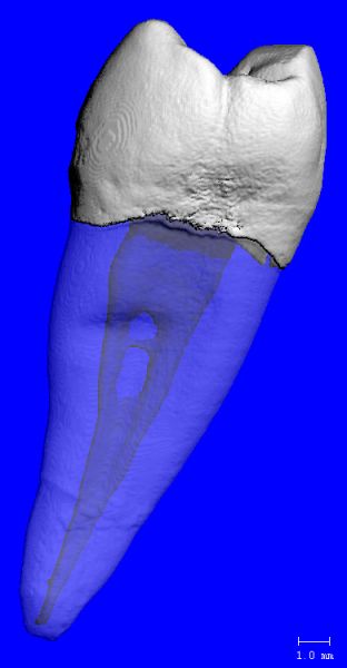 File:Human Tooth.jpg