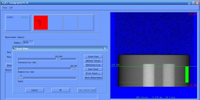 File:Uct tomography pic06.jpg