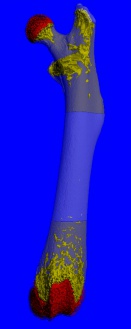 Mouse Femur showing Cortical and Trabecular Bone (10µm)
