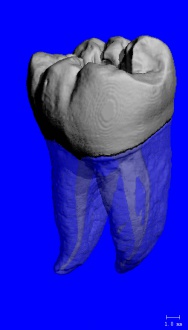 Human Tooth (60µm) Courtesy of Dr. C. Stewart