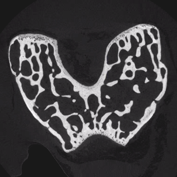 File:Xradia mouse distal femur.png