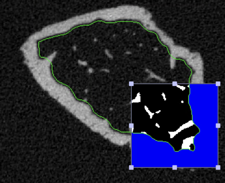 File:Segmentation mask.png