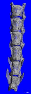 Mouse Spine showing Cortical and Trabecular Bone (10µm)